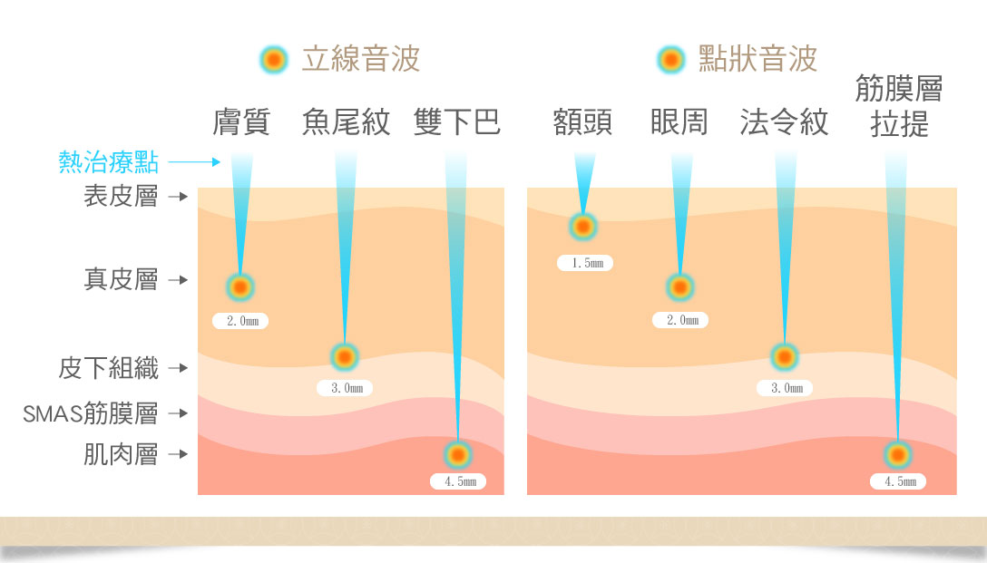 Q+立線音波治療原理