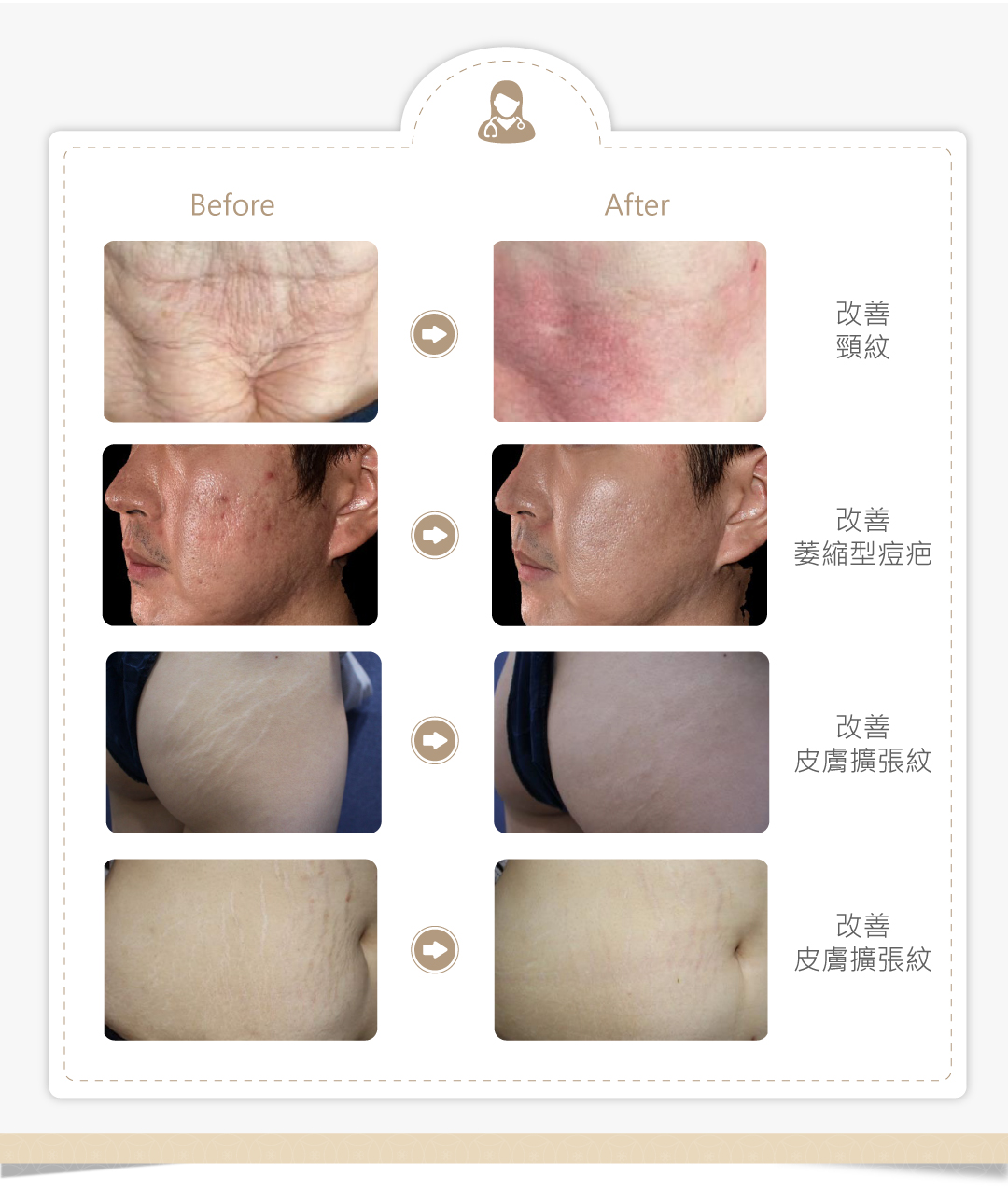 VIVABELLA 薇貝拉魔法針 案例分享
