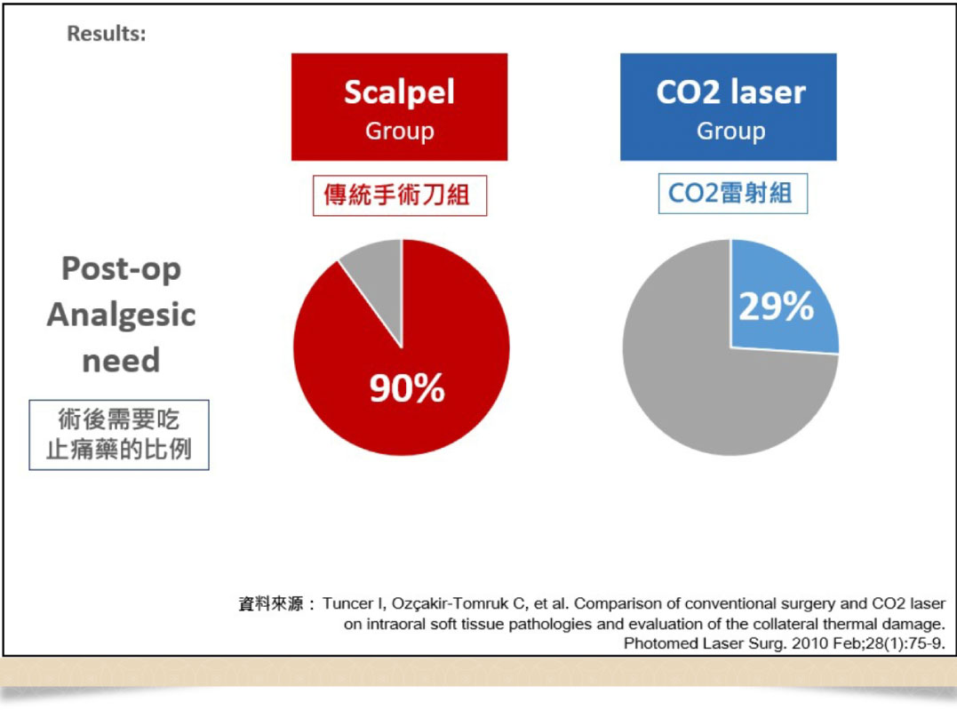 CO2雷射