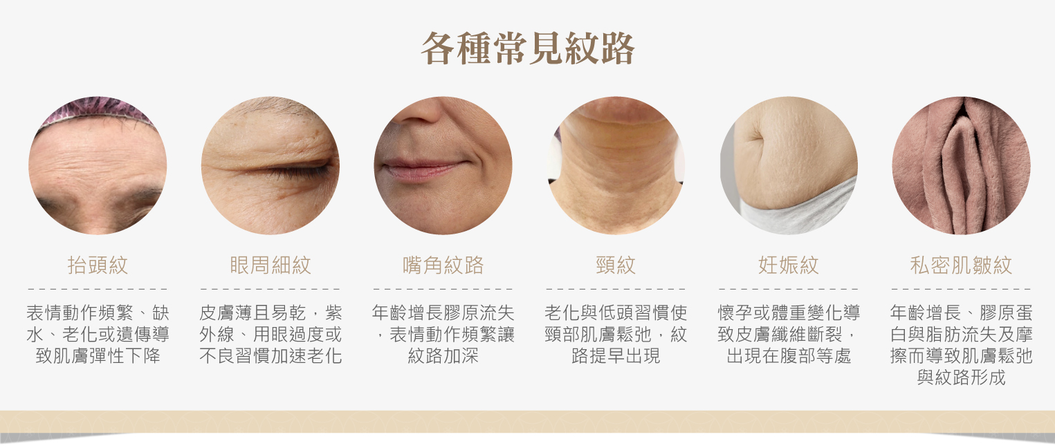 Tixel2 提可塑適用部位