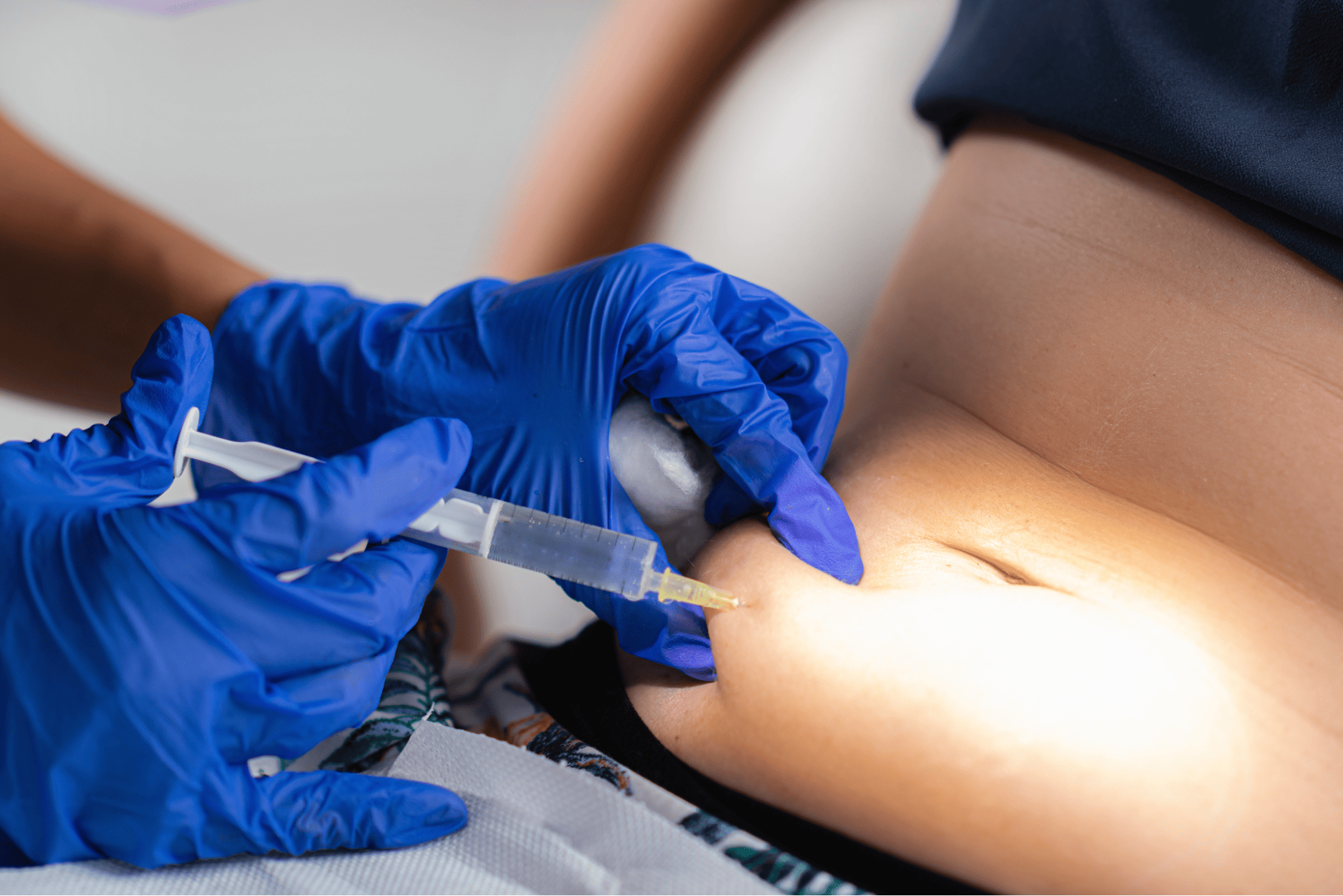 如何消除下腹部贅肉?諮詢消脂容脂針