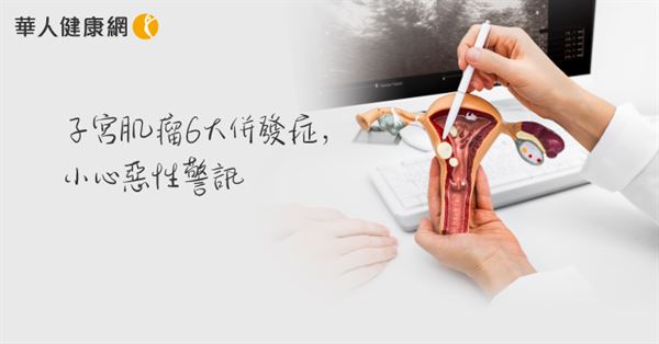 子宮肌瘤併發症