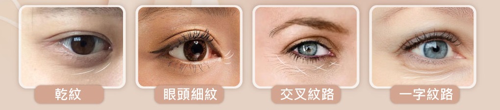 常見眼周紋路