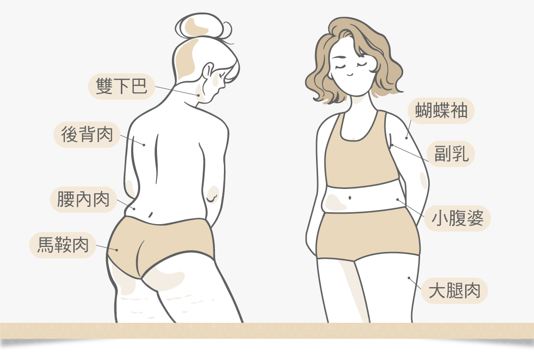 消脂針適用部位