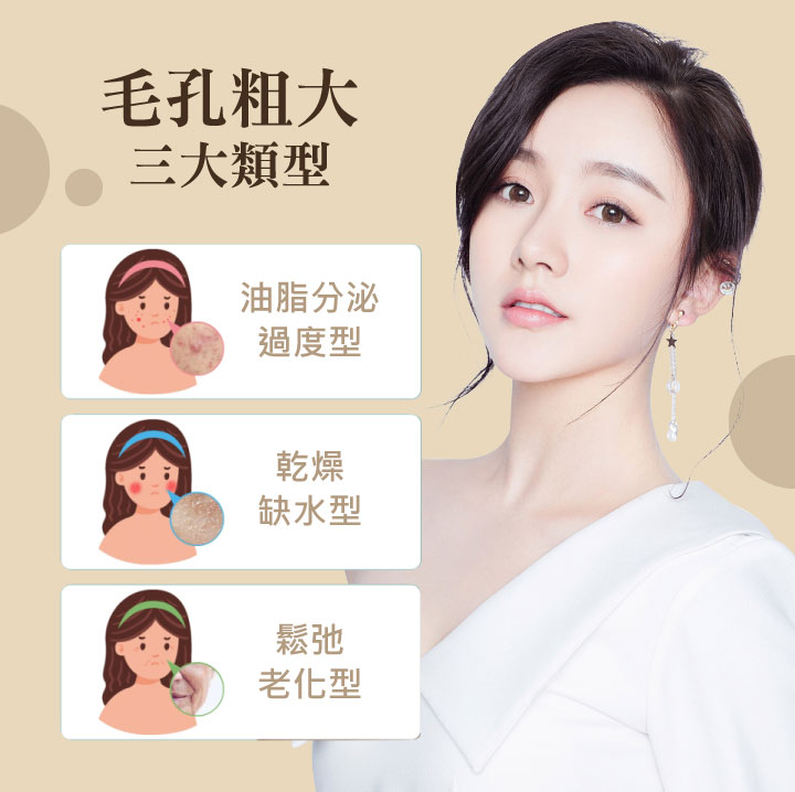 毛孔粗大類型