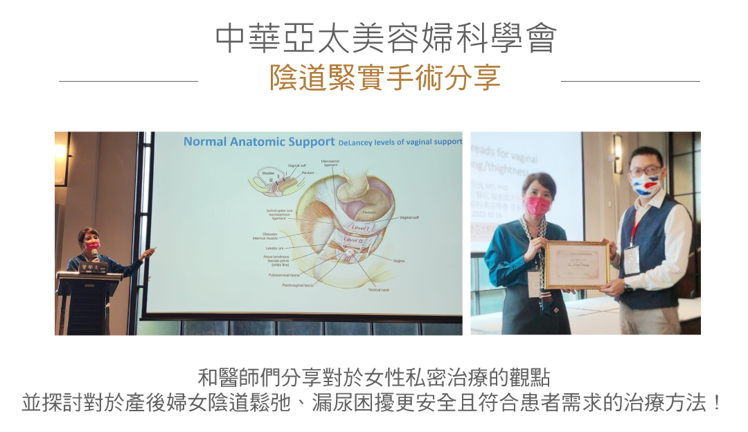 陰道緊實手術分享