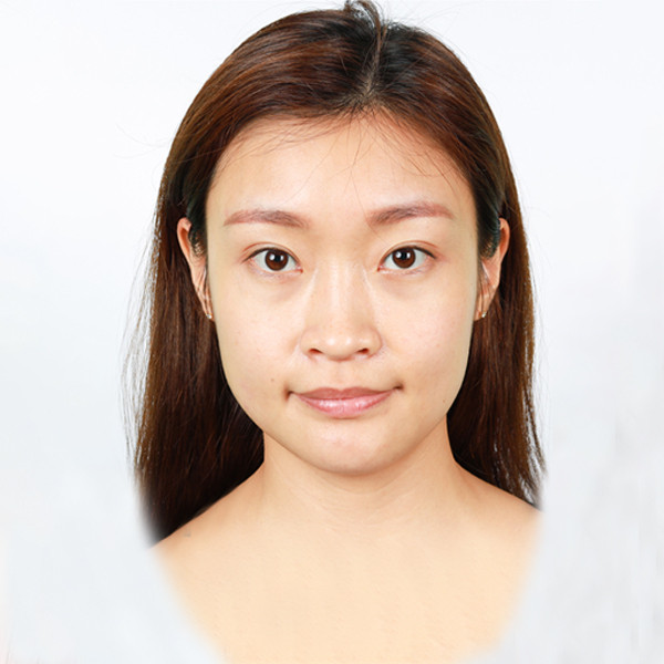 Sculptra 3D聚左旋乳酸 -Dolly