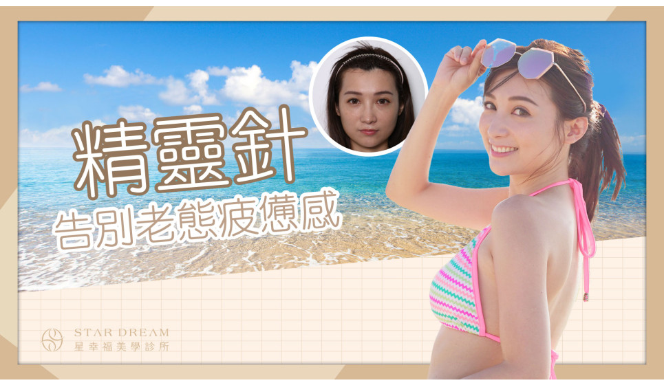 網紅美女江滴滴，年紀輕輕卻被說老？ 精靈針告別老態散發青春光采！