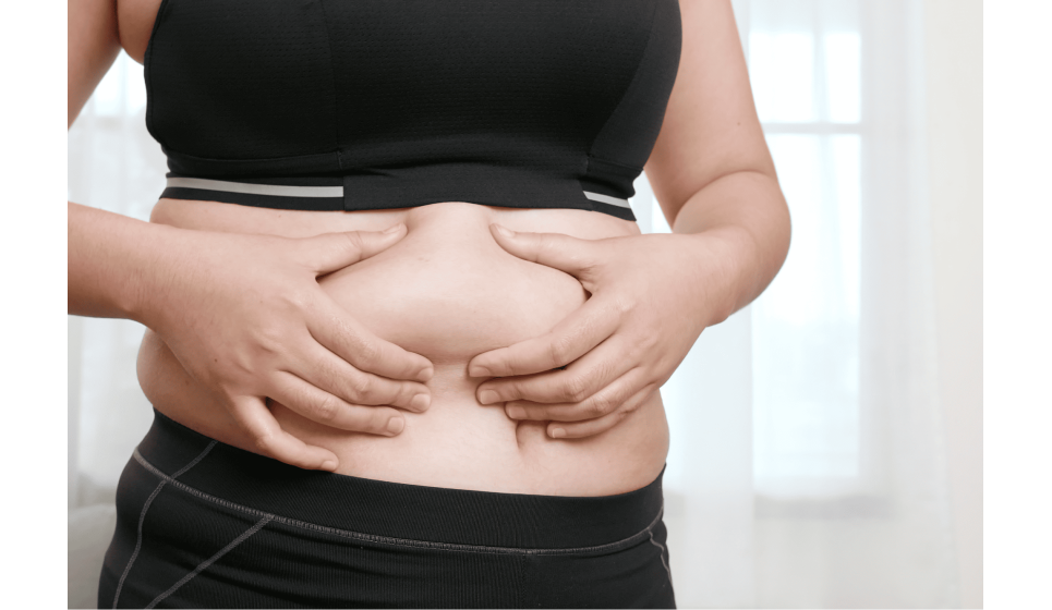 腹部脂肪堆積原因大解析！4大成因、消除方法與案例一次看