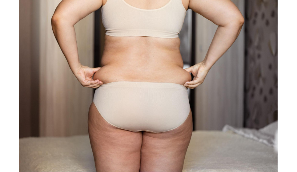 中年發福好難瘦？醫揭3大主因＋5招減肥方法逆轉肥胖！