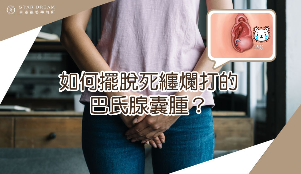 如何擺脫死纏爛打的巴氏腺囊腫？