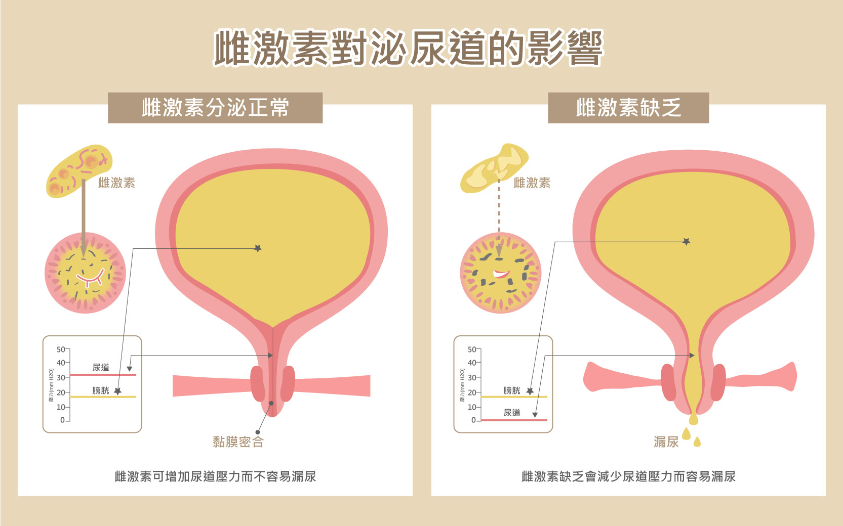 雌激素對女性漏尿的影響