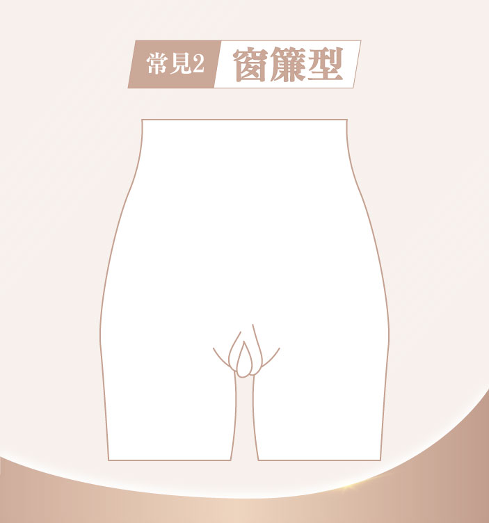 私密處形狀