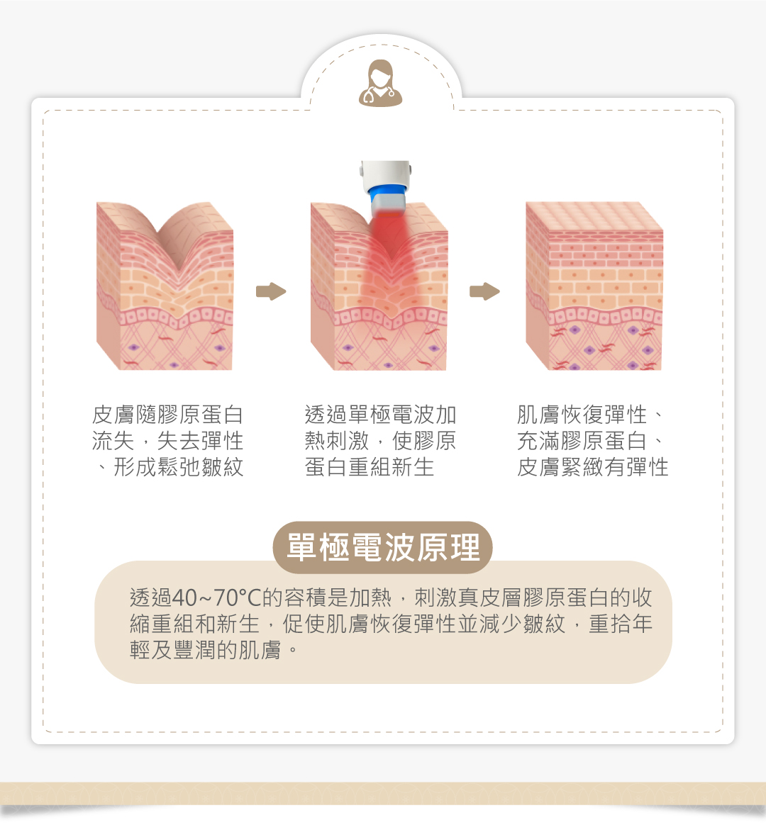 十蓓電波單極電波原理