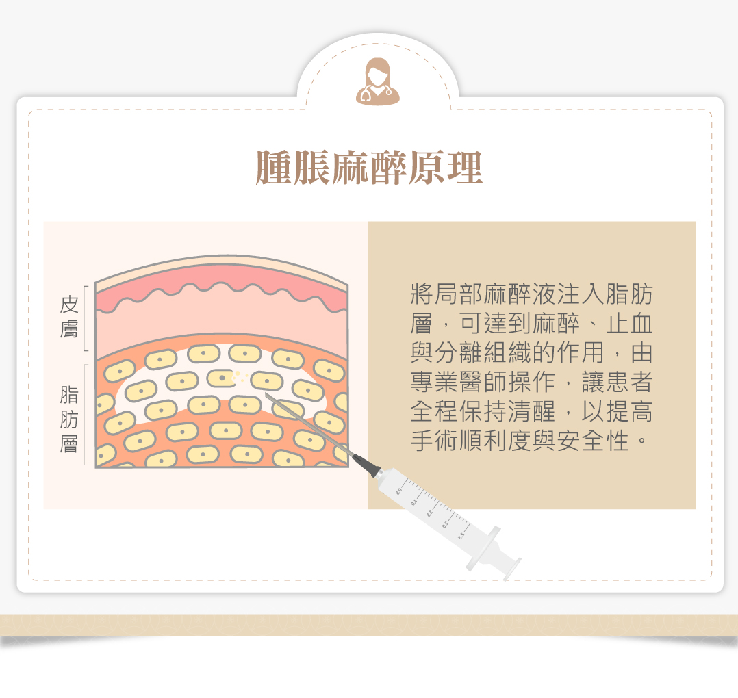 腫脹麻醉