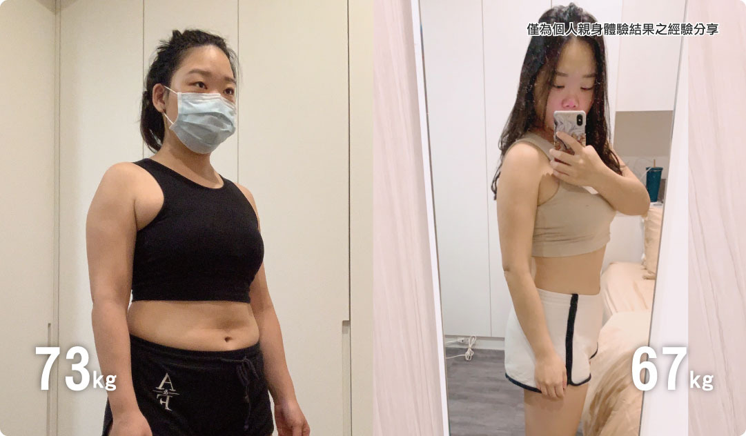 精準醫學減重門診案例分享：安安 / 上班族