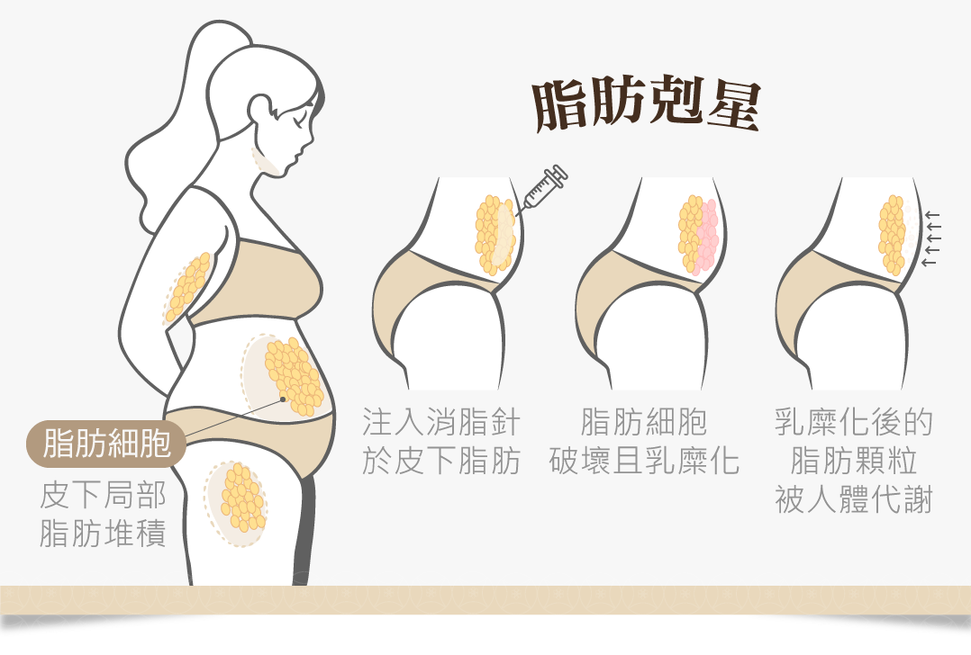 消脂針 局部消脂